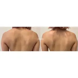 【ミニモ限定】美肌全身リンパマッサージ80分