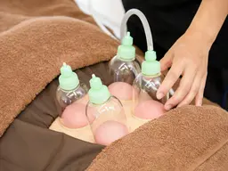 【肩こり/冷え/疲労におすすめ✨】カッピング🪽