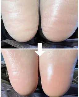 ガチガチかかともつるフワ！足裏角質ケア＋パックコース