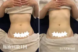 目指せ全身バランス美人！WINBACK＋全身コルギ　155分　骨盤矯正、デコルテ付