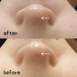 小顔&整体コルギ＆ハーブピーリング✨80分