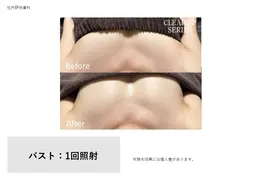 ふっくらバストケア