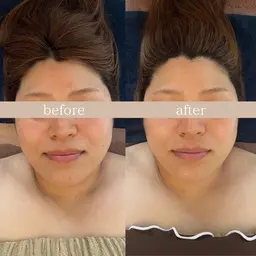 【ご新規様限定✨】本格的！本場韓国式🇰🇷韓国アイドル必須項目✅小顔筋膜リリースコルギコース💆🏻‍♀️💕