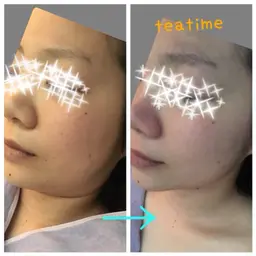 モニター募集　美肌＆整体エステ