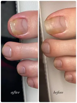 3/19 12:00〜限定【フット】自爪ケア&角質ケア