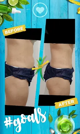 「ミニモ限定」大宮発！激安大盤振る舞いオールフリープランの120分！何でも出来ちゃう！脱毛？痩身？美顔も？