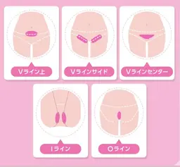 U24🎀シェービング付VIO脱毛🎀冷却機能・デザイン自由・美白👌本気で毛をなくしたい方へ💍目指せ自己処理卒業🌟