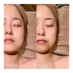 頭皮とお肌の肌質改善スペシャルメニュー✨無農薬スパとシリカをベースとしたフェイシャルエステで両方ツルツル