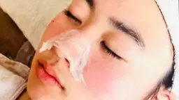 毛穴黒ずみケアビフォーアフター写真モデル