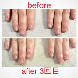 美爪ケア⭐︎育爪⭐︎クリアジェルモデル様募集　自爪が短い方、深爪の方、噛み癖のある方など⭐︎３回施術してくださる方募集
