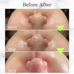 韓国式美肌毛穴洗浄🇰🇷✨【鼻のみ】