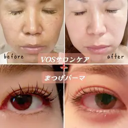とってもお得💥【肌質改善】ニキビ・毛穴・シミ・シワなどお肌悩みに🌹フェイシャル+まつげパーマのセット16,000円