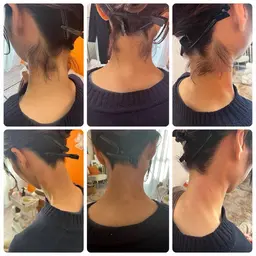 【うなじ】ブラジリアンWax✖️光脱毛🧡　事前処理なしでツルツル肌へ✨