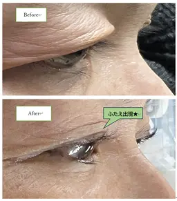 アイラッシュ　ラッシュリフト　まつ毛パーマ