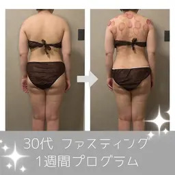 【無料カウンセリング】体質改善ファスティングをしたい方の事前カウンセリングです。