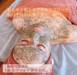 当店人気No.1👏✨本気で肌荒れを治したい方にオススメ❣️剥けない幹細胞ハーブピーリング【お顔】2g