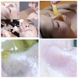 糸美容コース 顔ダニ、角質、毛穴の汚れが気になる方。ニキビ肌、乾燥肌の方にオススメティアラの糸美容フェイシャル！