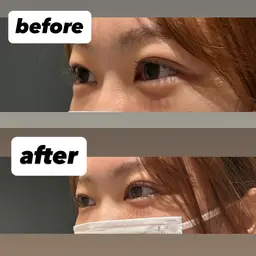 OPEN価格‼️まつげパーマ✨(⚠️マスカラ・マツエクなどのオフがある方は事前にお知らせください)