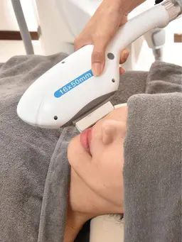 全身＋顔(うなじ、VIOなし) 脱毛