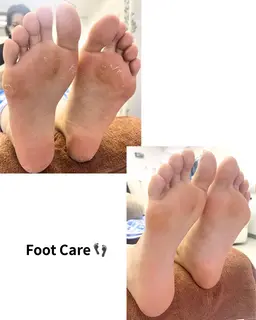 フットケア👣足裏角質除去／ファイリング ／甘皮処理👣【練習モニター】 期間限定¥5980→¥1500