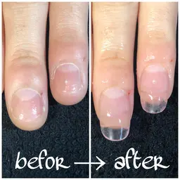 爪噛みさん用爪の矯正&長さ出しお試し2本コンプレックス応援企画📣