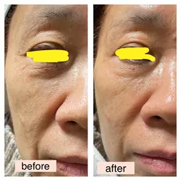 お肌を若返らせたい方に❤️いくつになってからでも変わります✨お任せください‼︎極上フェイシャルマッサージ✨