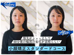 《小顔矯正スタンダードコース💆‍♀️》小顔矯正 60分 ¥12,100→初回¥4,980