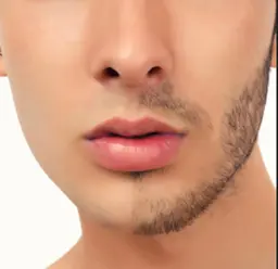 【メンズ脱毛】メンズ脱毛NO.1👱♂️お顔脱毛・1番気になる頬骨下からアゴまでをスッキリ脱毛❗️毎日の髭剃りから解放