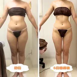 【本気🔥&全部痩せ希望の方⚠️】痩身全身×2回✨骨格矯正も🙆🏻‍♀️代謝の上がる冬はダイエットのチャンス！！