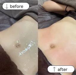 《腹部痩身✨》