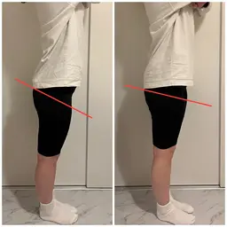 《minimo限定✨》骨盤矯正60分⭐️