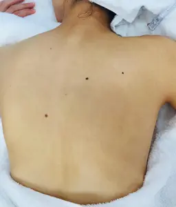 フェイシャル&背面アロママッサージ❣️