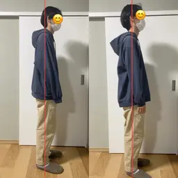 姿勢改善（猫背矯正・骨盤矯正）体験【カウンセリング込み】