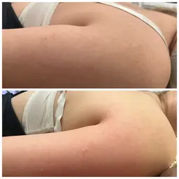 【今話題‼️】1回目で効果がわかる速効性✨️脂肪をなくしサイズダウン✨️🍋 ボトル1cc ¥6,900→¥2,980