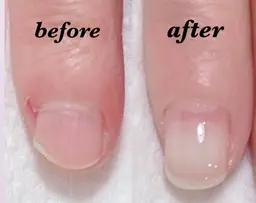 【自爪育成🌸深爪緩和🌸噛み爪🌸】爪にお悩みがある方へ🕊クリアジェル仕上げ🕊