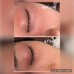 初回限定 センシティブ(アトピー)ケアコース『イオン効果でゴワゴワお肌がふっくら柔らか🥰』首、デコルテマッサージ付き✨