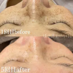 フェイシャルワックス