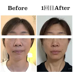 40代からのたるみに/土台から整える小顔ケアヘッドスパ付き