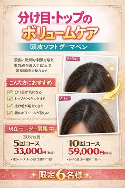 【Newコース】頭皮ソフトダーマペン✨分け目・トップふんわり復活🌿初回4,400円