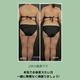 筋膜リリース(90分)