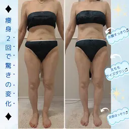 最新痩身機器で全身トリートメント⭐︎100分