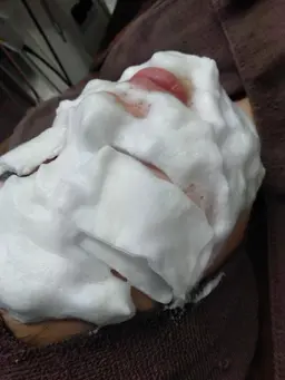 《トライアル》肌荒れ・赤ら顔ケア 50分