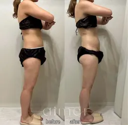 12月限定🎅🏻🎀 全身｜ハイパーナイフ70分