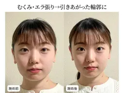 【横顔までキレイな印象美人】小顔整体＋4D小顔矯正＋姿勢矯正　12000円→