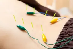 頑固な腰痛撃退✨鍼通電施術✨