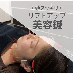 【頭スッキリ】　リフトアップ美容鍼