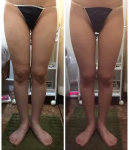 痩せにくい方🔥疲労が取れない方オススメ❣半身ボディ✨セルライト/肩こり/腰痛/むくみ/キレイなラインを作りたい方！