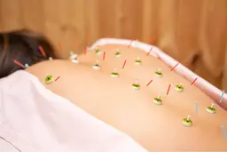 【首肩こり・頭痛・猫背・巻き肩・腰痛・反り腰・足のむくみに】✨お悩みに合わせて施術✨鍼灸・カッピング・かっさ‼️