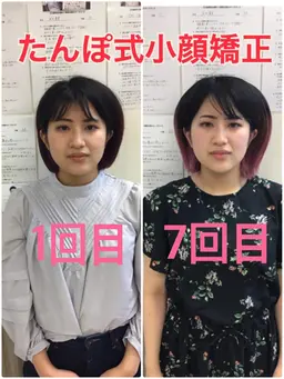 【モニター残り1名】全身プロポーション矯正✖️本格小顔矯正