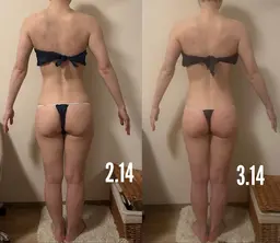 🆕体質改善サーモケア✨120分✨インディバ最新機種同等ハイスペック深部加熱マシーン➕吸引器➕カッピング